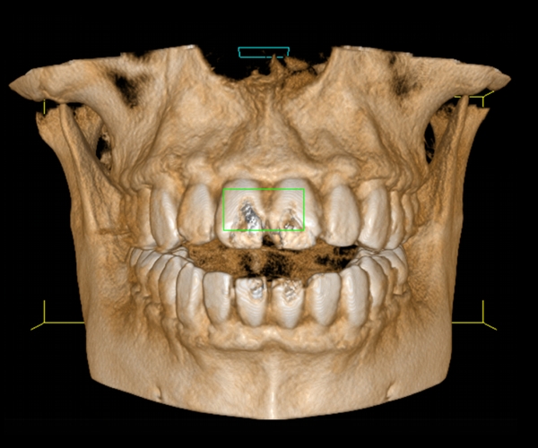 TC Dentale Cone Beam – Dentalscan