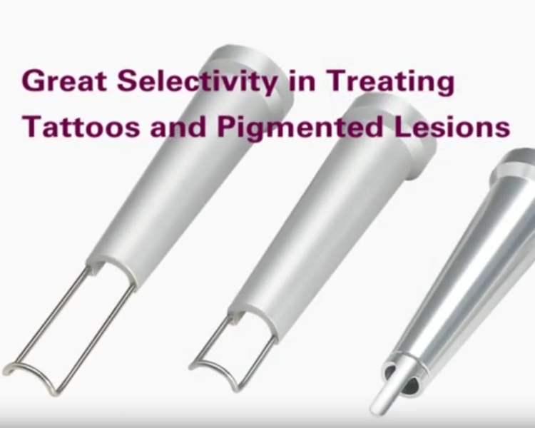 Laser Duolite Q-Switch per rimuovere tatuaggi e macchie della pelle